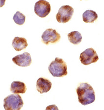Immunocytochemistry - Anti-IRAK4 antibody - C-terminal (AB189108), expandable thumbnail