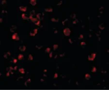 Immunocytochemistry/ Immunofluorescence - Anti-IRAK4 antibody - C-terminal (AB189108)