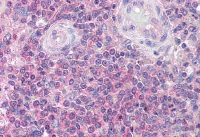 Immunohistochemistry (Formalin/PFA-fixed paraffin-embedded sections) - Anti-IRAK4 antibody - C-terminal (AB189108)