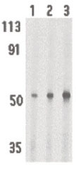 Western blot - Anti-IRAK4 antibody - C-terminal (AB189108), expandable thumbnail
