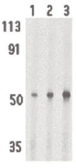 Western blot - Anti-IRAK4 antibody - C-terminal (AB189108)