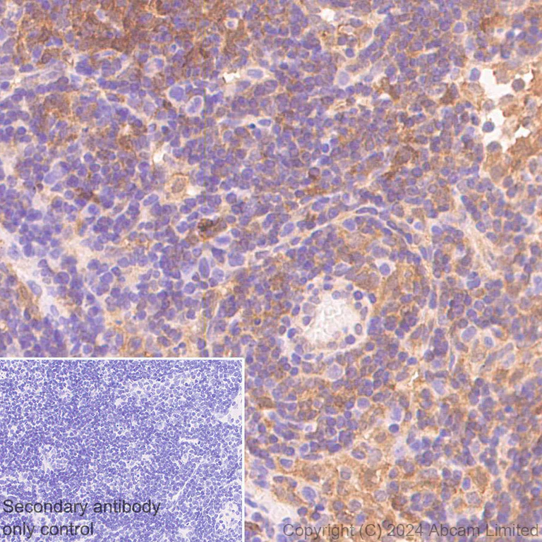 Immunohistochemistry (Formalin/PFA-fixed paraffin-embedded sections) - Anti-IRAK4 antibody [EPR26377-254] (AB318954)
