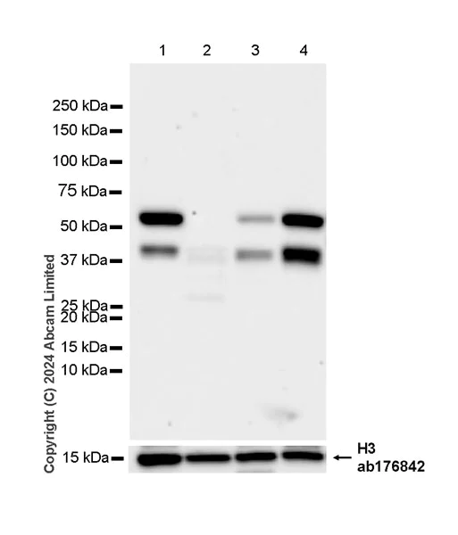 Western blot - Anti-IRAK4 antibody [EPR26377-254] (AB318954)