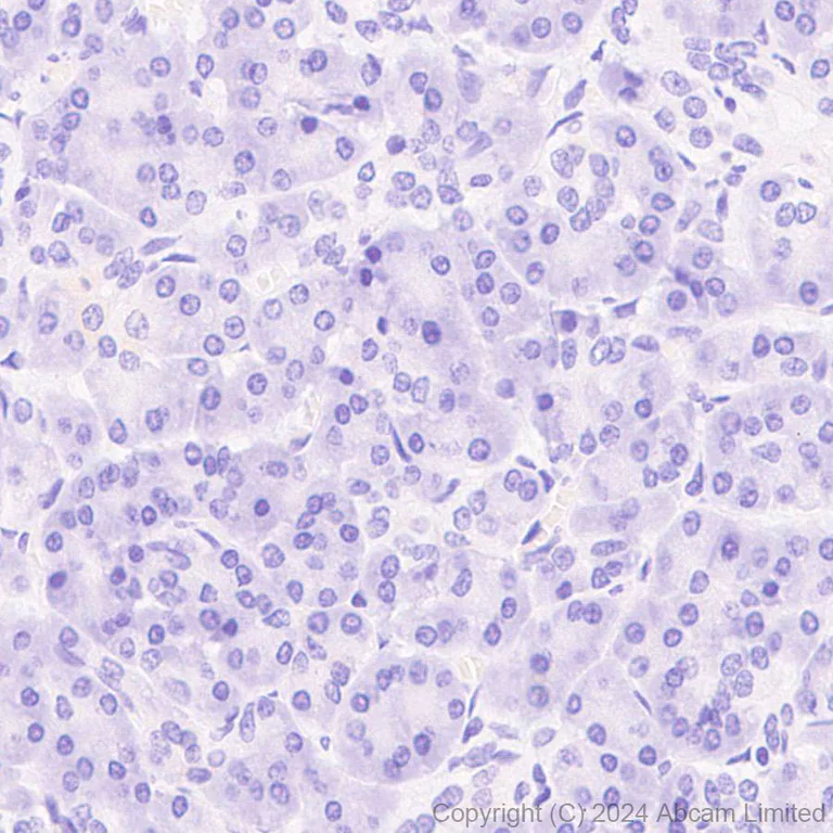 Immunohistochemistry (Formalin/PFA-fixed paraffin-embedded sections) - Anti-IRAK4 antibody [EPR26377-254] - BSA and Azide free (AB318955)