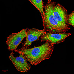 Immunocytochemistry/ Immunofluorescence - Anti-IRAKM antibody [5C3D6] - C-terminal (AB216132)