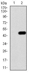 Western blot - Anti-IRAKM antibody [5C3D6] - C-terminal (AB216132)