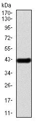Western blot - Anti-IRAKM antibody [5C3D6] - C-terminal (AB216132)