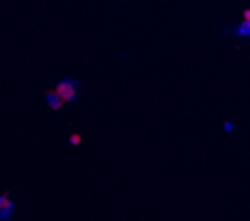 Immunocytochemistry - Anti-IRAKM antibody (AB8116), expandable thumbnail