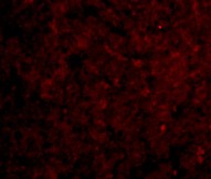 Immunocytochemistry - Anti-IRAKM antibody (AB8116), expandable thumbnail