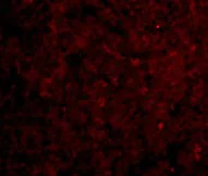 Immunocytochemistry - Anti-IRAKM antibody (AB8116)