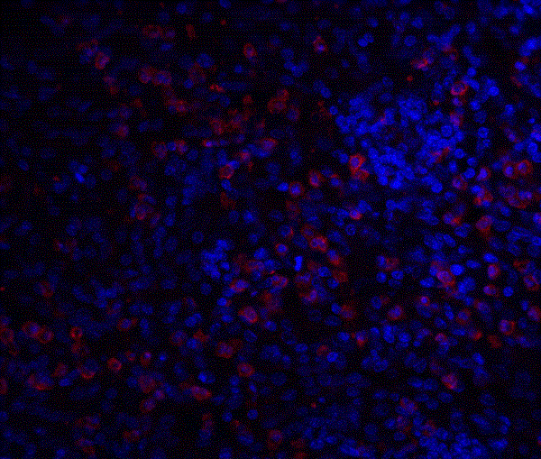 Immunohistochemistry (Formalin/PFA-fixed paraffin-embedded sections) - Anti-IRAKM antibody (AB8116), expandable thumbnail