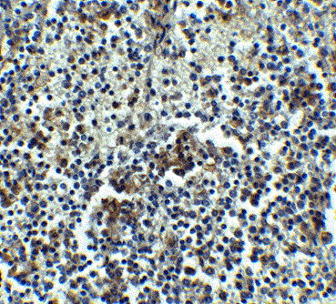 Immunohistochemistry (Formalin/PFA-fixed paraffin-embedded sections) - Anti-IRAKM antibody (AB8116), expandable thumbnail