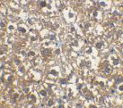Immunohistochemistry (Formalin/PFA-fixed paraffin-embedded sections) - Anti-IRAKM antibody (ab8116), expandable thumbnail