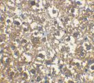 Immunohistochemistry (Formalin/PFA-fixed paraffin-embedded sections) - Anti-IRAKM antibody (AB8116)