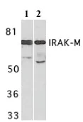 Western blot - Anti-IRAKM antibody (AB8116)