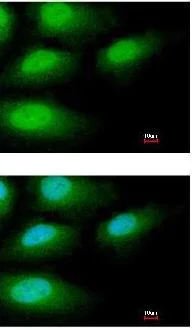 Immunocytochemistry/ Immunofluorescence - Anti-IRAKM antibody (AB97518)