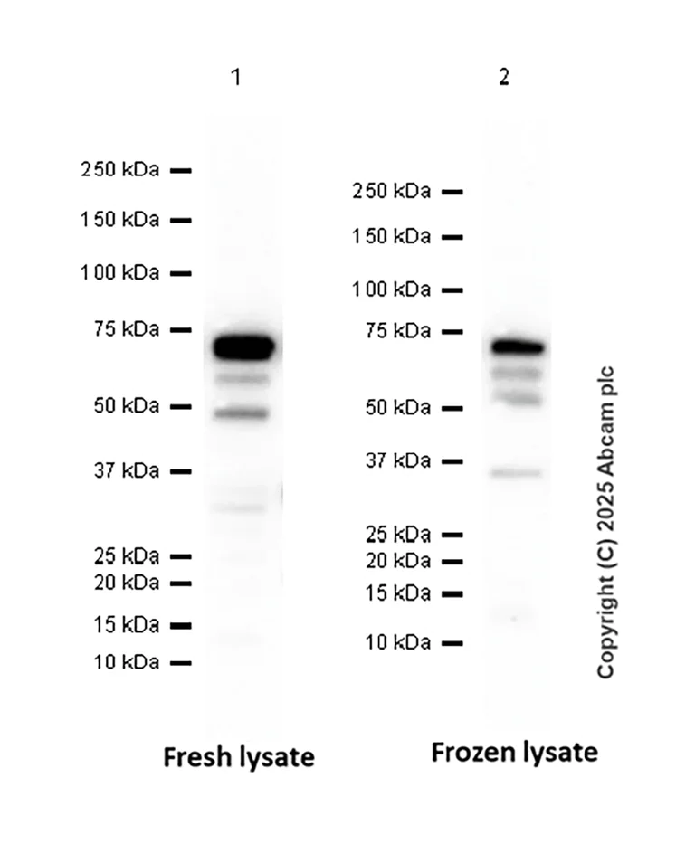 Western blot - Anti-IRAKM antibody [EPR26376-117] (AB307708)