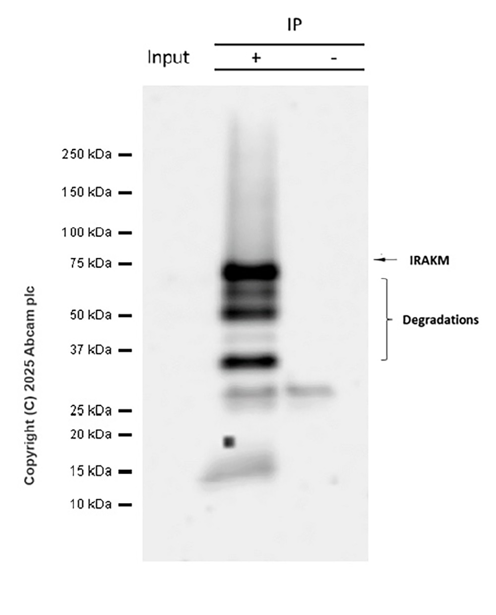 Immunoprecipitation - Anti-IRAKM antibody [EPR26376-117] - BSA and Azide free (AB307709), expandable thumbnail