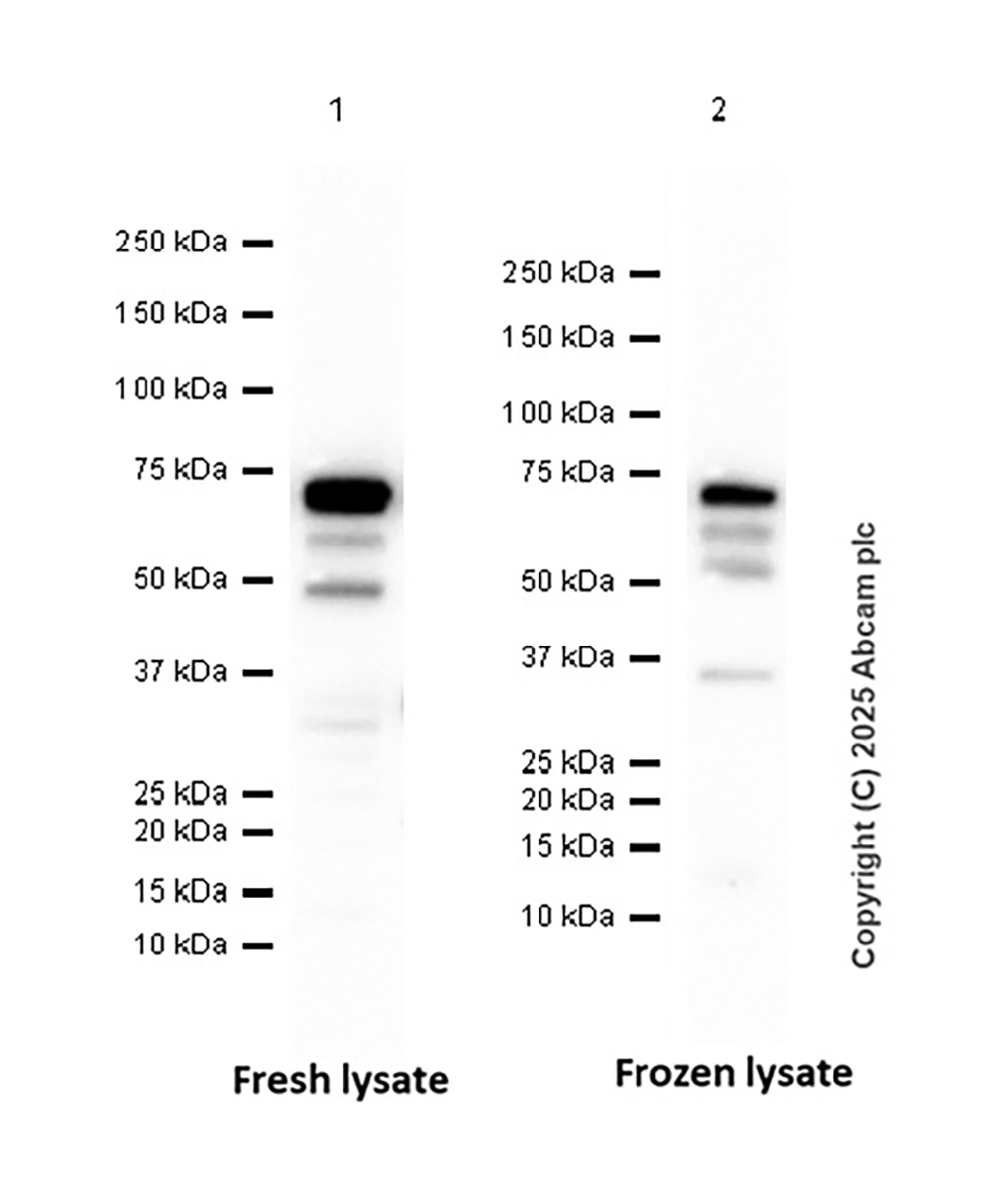 Western blot - Anti-IRAKM antibody [EPR26376-117] - BSA and Azide free (AB307709), expandable thumbnail
