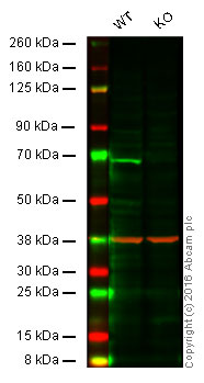 Western blot - Anti-IRAKM antibody [Y278] (AB32394), expandable thumbnail
