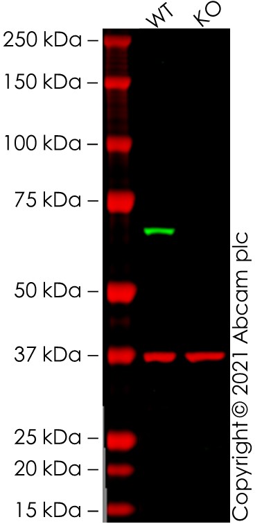 Western blot - Anti-IRAKM antibody [Y278] (AB32394), expandable thumbnail