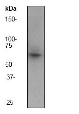 Western blot - Anti-IRAKM antibody [Y278] (AB32394), expandable thumbnail