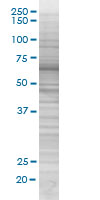 SDS-PAGE - IRAKM overexpression 293T lysate (whole cell) (AB94127), expandable thumbnail