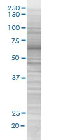 SDS-PAGE - IRAKM overexpression 293T lysate (whole cell) (AB94127)