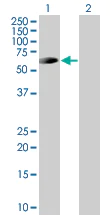 Western blot - IRAKM overexpression 293T lysate (whole cell) (AB94127)