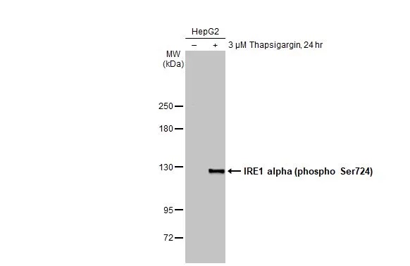 Western blot - Anti-IRE1 alpha (phospho Ser724) antibody [HL1885] (AB308387), expandable thumbnail