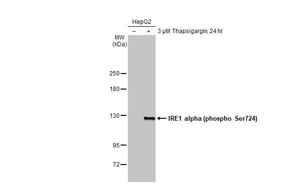 Western blot - Anti-IRE1 alpha (phospho Ser724) antibody [HL1885] (AB308387)
