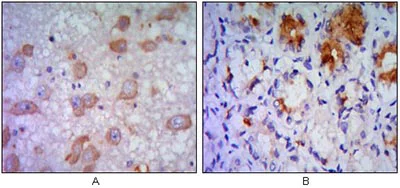 Immunohistochemistry (Formalin/PFA-fixed paraffin-embedded sections) - Anti-IRE1 antibody [9F2] (AB96481)