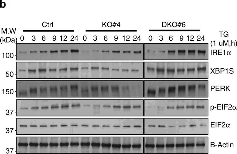 Western blot - Anti-IRE1 antibody [9F2] (AB96481)