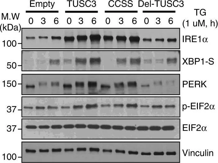 Western blot - Anti-IRE1 antibody [9F2] (AB96481)