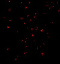 Immunocytochemistry - Anti-IRE1 antibody (AB37073)