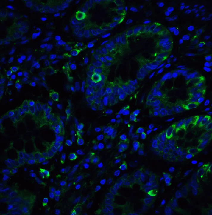 Immunohistochemistry (Formalin/PFA-fixed paraffin-embedded sections) - Anti-IRE1 antibody (AB37073)