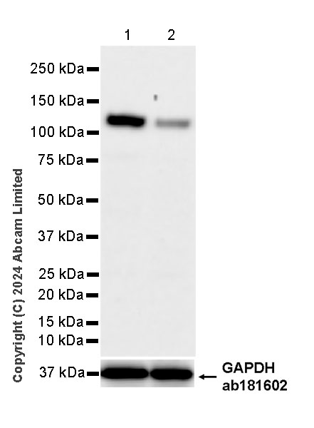 Western blot - Anti-IRE1 antibody [EPR29162-31] (AB322061), expandable thumbnail
