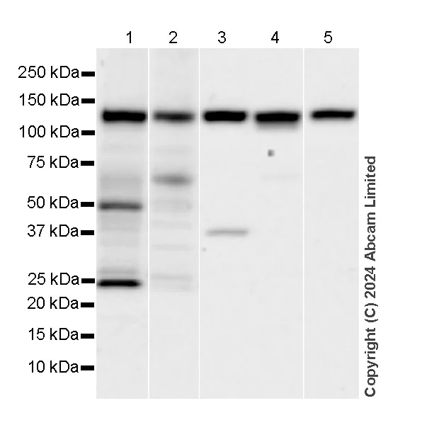 Western blot - Anti-IRE1 antibody [EPR29162-31] (AB322061)