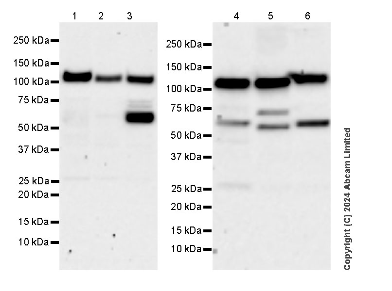 Western blot - Anti-IRE1 antibody [EPR29162-31] (AB322061), expandable thumbnail