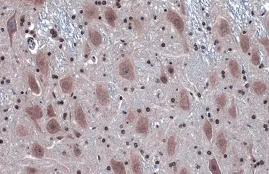 Immunohistochemistry (Formalin/PFA-fixed paraffin-embedded sections) - Anti-IRE1 antibody - N-terminal (AB227245)