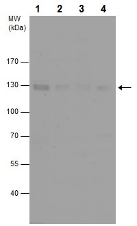 Western blot - Anti-IRE1 antibody - N-terminal (AB227245)