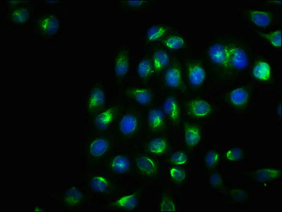 Immunocytochemistry - Anti-IRE1 (phospho S724) antibody [1F12] (AB288371)