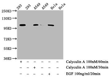 Western blot - Anti-IRE1 (phospho S724) antibody [1F12] (AB288371)