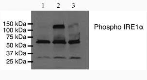 Western blot - Anti-IRE1 (phospho S724) antibody (AB48187)