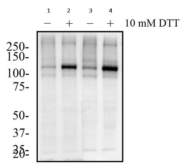 Western blot - Anti-IRE1 (phospho S724) antibody (AB48187)