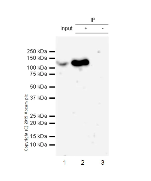 Immunoprecipitation - Anti-IRE1 (phospho S724) antibody [EPR23107-16] (AB243665)