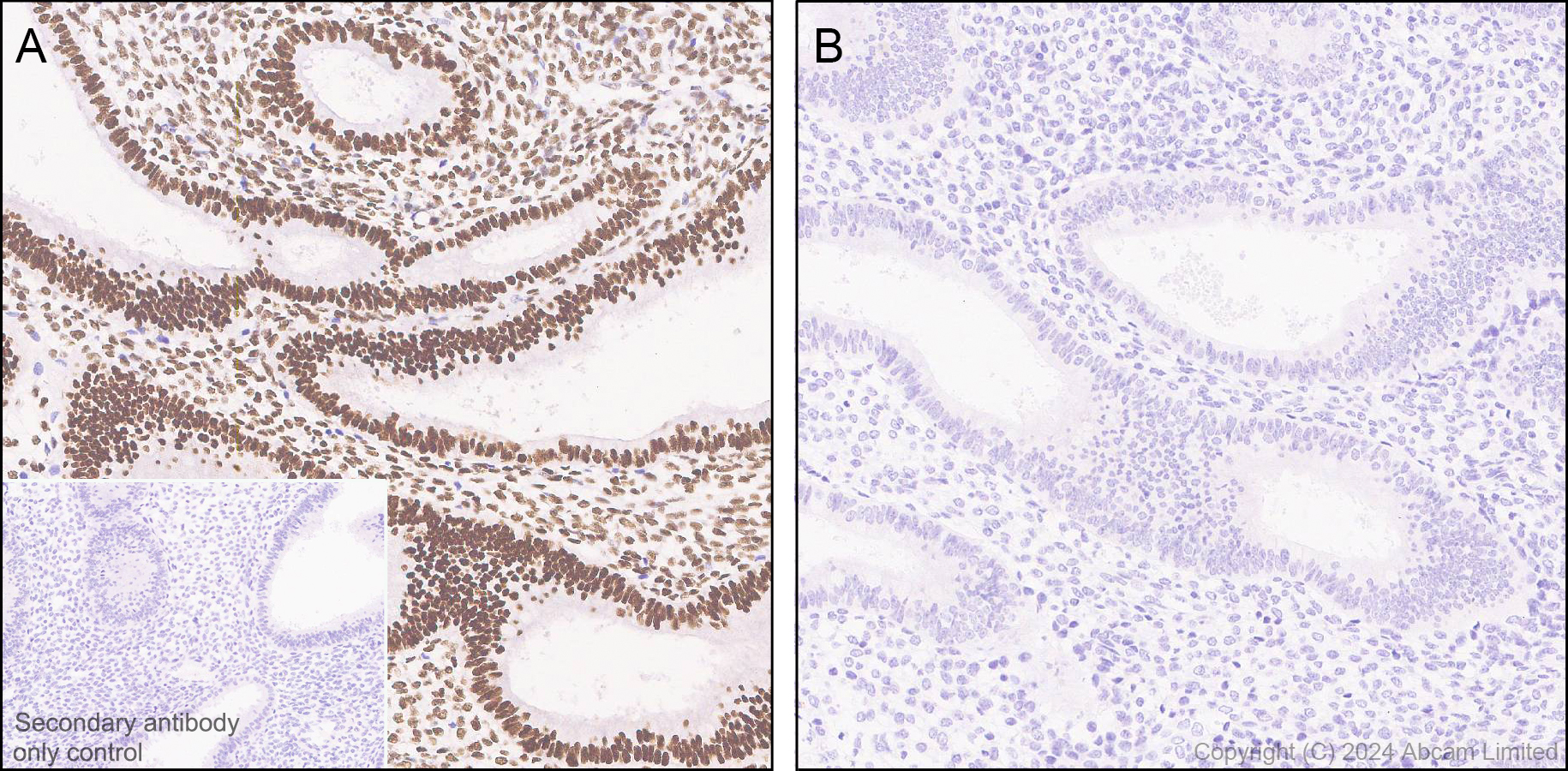 Immunohistochemistry (Formalin/PFA-fixed paraffin-embedded sections) - Anti-IRE1 (phospho S724) antibody [EPR26009-269] (ab324051), expandable thumbnail