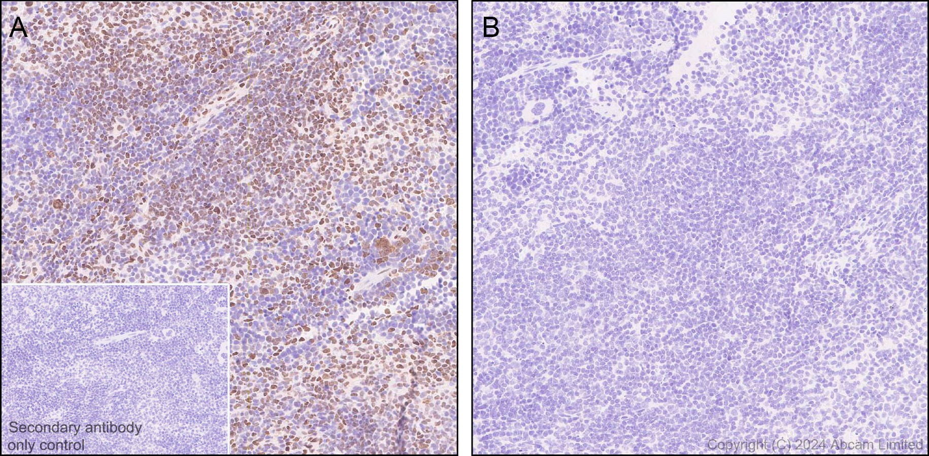 Immunohistochemistry (Formalin/PFA-fixed paraffin-embedded sections) - Anti-IRE1 (phospho S724) antibody [EPR26009-269] (ab324051), expandable thumbnail