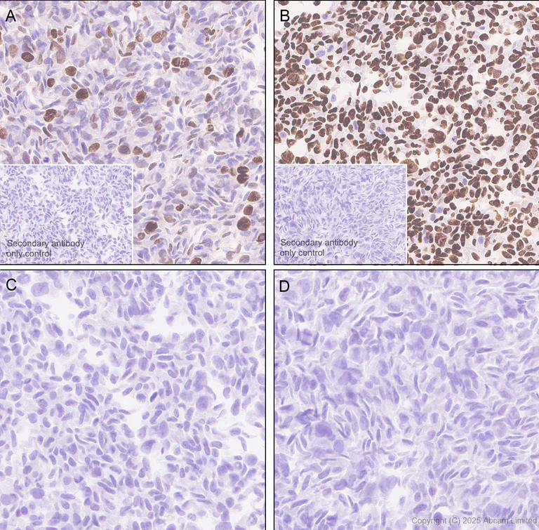 Immunohistochemistry (Formalin/PFA-fixed paraffin-embedded sections) - Anti-IRE1 (phospho S724) antibody [EPR26009-269] (AB324051)