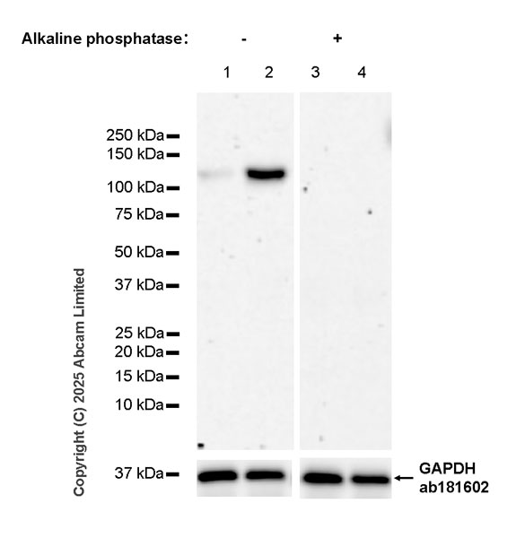 Western blot - Anti-IRE1 (phospho S724) antibody [EPR26009-269] (AB324051), expandable thumbnail